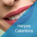 Herpes / Calentora